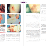 دانلود پی دی اف کتاب اصول کمک های اولیه و احیاء دکتر زیبا ایوبیان و دکتر غلامرضا پورحیدری PDF