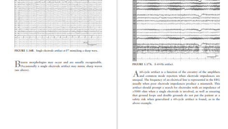 دانلود پی دی اف کتاب PDF handbook of EEG william tutam