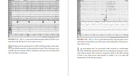 دانلود پی دی اف کتاب PDF handbook of EEG william tutam