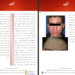 دانلود پی دی اف کتاب بیماریهای شایع پوست و مو PDF