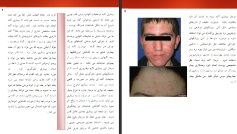 دانلود پی دی اف کتاب بیماریهای شایع پوست و مو PDF