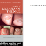 دانلود پی دی اف کتاب PDF An Atlas of Diseases of the Nail Phoebe Rich