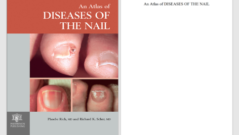 دانلود پی دی اف کتاب PDF An Atlas of Diseases of the Nail Phoebe Rich