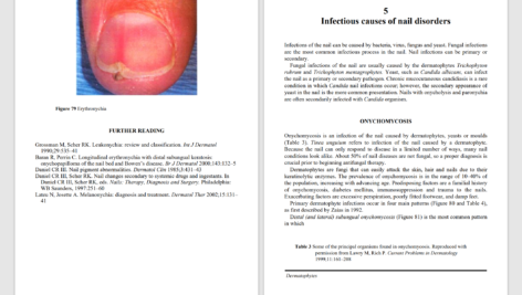 دانلود پی دی اف کتاب PDF An Atlas of Diseases of the Nail Phoebe Rich