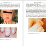 دانلود پی دی اف کتاب PDF An Atlas of Diseases of the Nail Phoebe Rich