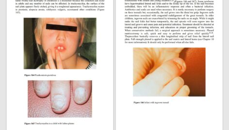 دانلود پی دی اف کتاب PDF An Atlas of Diseases of the Nail Phoebe Rich