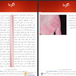 دانلود پی دی اف کتاب بیماریهای شایع پوست و مو PDF
