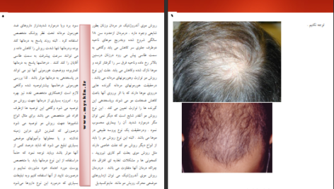 دانلود پی دی اف کتاب بیماریهای شایع پوست و مو PDF