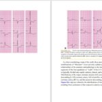 دانلود پی دی اف کتاب ماریوت الکتروکاردیوگرافی عملی PDF