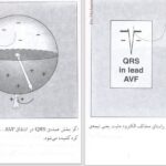 دانلود پی دی اف کتاب خواندن فوری الکتروکاردیوگرام دیل دوبین PDF