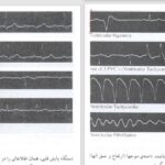 دانلود پی دی اف کتاب خواندن فوری الکتروکاردیوگرام دیل دوبین PDF