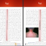 دانلود پی دی اف کتاب بیماریهای شایع پوست و مو PDF
