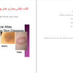 دانلود پی دی اف کتاب اطلس بیماری های پوست و ناخن دکتر فرشاد اکبرنژاد PDF