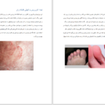 دانلود پی دی اف کتاب اطلس بیماری های پوست و ناخن دکتر فرشاد اکبرنژاد PDF