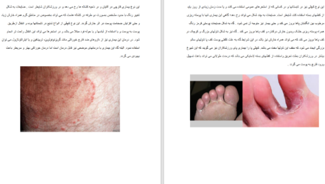 دانلود پی دی اف کتاب اطلس بیماری های پوست و ناخن دکتر فرشاد اکبرنژاد PDF