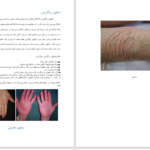 دانلود پی دی اف کتاب اطلس بیماری های پوست و ناخن دکتر فرشاد اکبرنژاد PDF