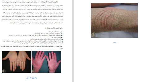 دانلود پی دی اف کتاب اطلس بیماری های پوست و ناخن دکتر فرشاد اکبرنژاد PDF