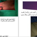دانلود پی دی اف کتاب تراکئوتومی عباس خلیل پور PDF