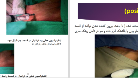 دانلود پی دی اف کتاب تراکئوتومی عباس خلیل پور PDF