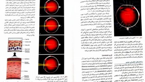 دانلود پی دی اف کتاب جراحی چشم الکساندر PDF