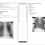 دانلود پی دی اف کتاب PDF A_Z of Chest Radiology