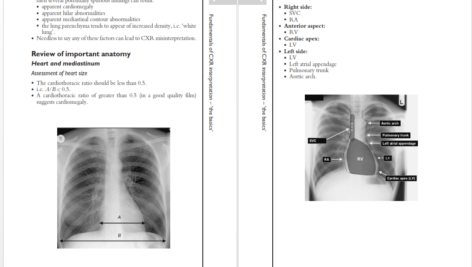 دانلود پی دی اف کتاب PDF A_Z of Chest Radiology