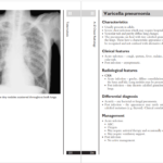 دانلود پی دی اف کتاب PDF A_Z of Chest Radiology