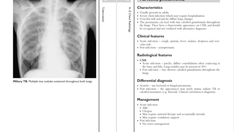 دانلود پی دی اف کتاب PDF A_Z of Chest Radiology