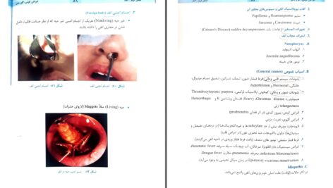 دانلود پی دی اف کتاب امراض گوش ، گلو و بینی دکتر هدایت الله صالحی دکتر باصره شریفی PDF